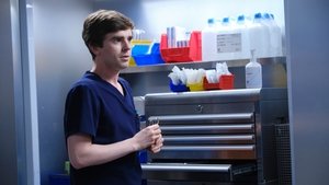 Dobrý doktor Úhel 45 stupňů