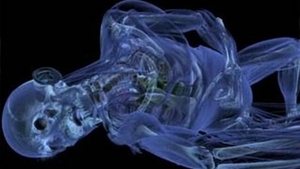 1000 Ways to Die 9. epizoda